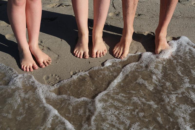 Hammertoes 